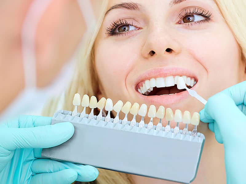 Teeth Whitening in Vaughan, ON